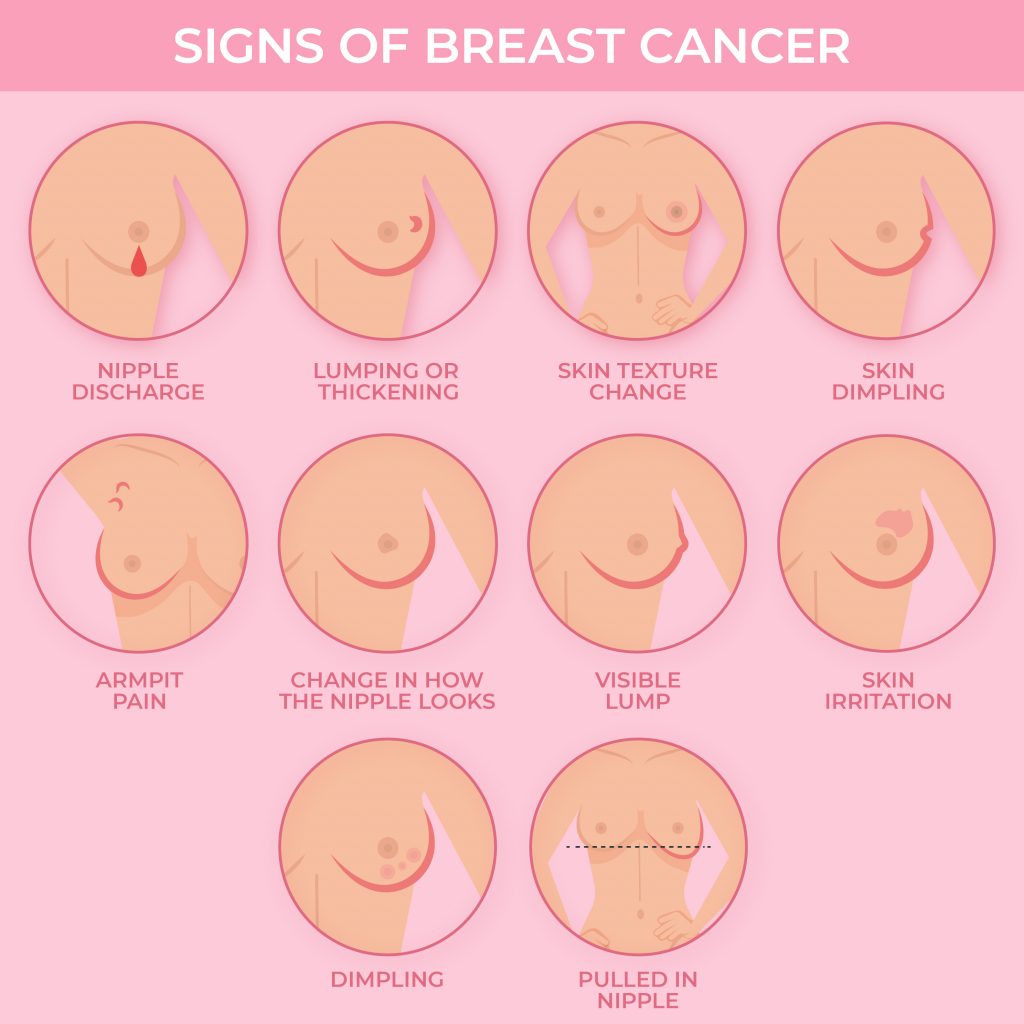 signs of breast cancer 